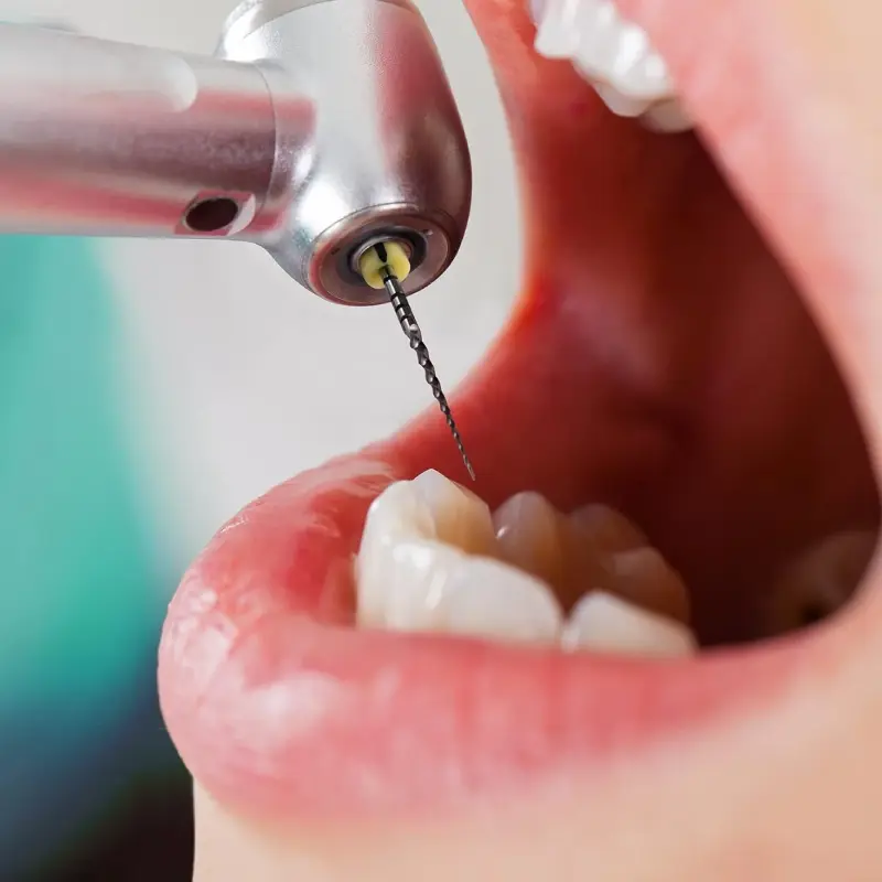 Endodontics